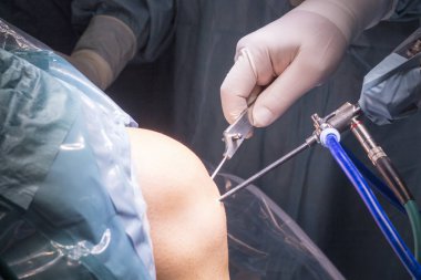 Cerrahi operasyon diz cerrahisi