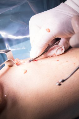 Cerrahi operasyon diz cerrahisi