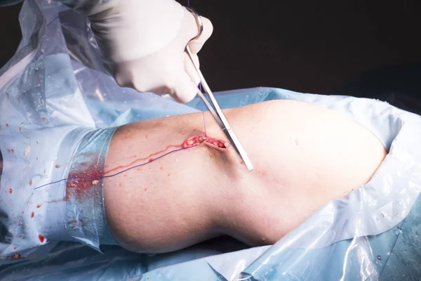 Surgical operation knee surgery