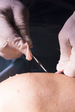 Cerrahi operasyon diz cerrahisi