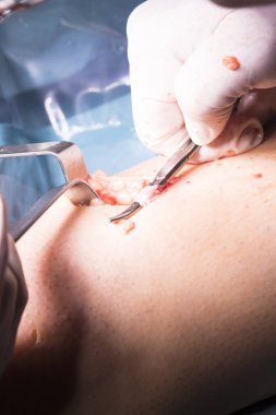 Cerrahi operasyon diz cerrahisi