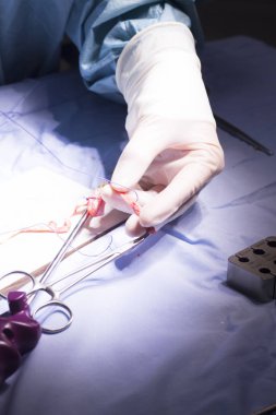 Diz tendon bağ ameliyatı