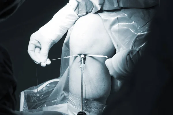 Kirurgisk operation knäoperation — Stockfoto