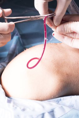 Cerrahi operasyon diz cerrahisi