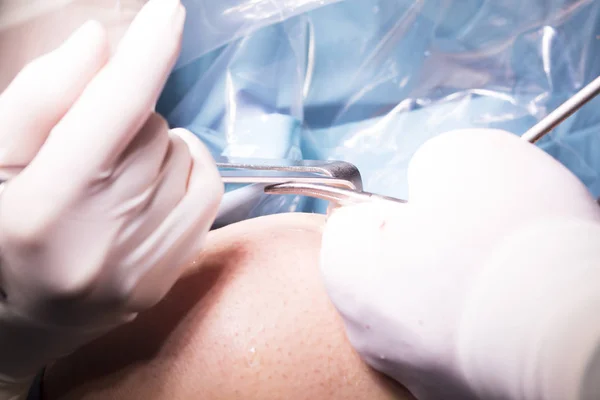 手術膝の手術 — ストック写真