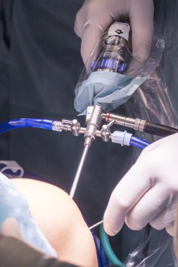 Cerrahi operasyon diz cerrahisi