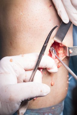 Cerrahi operasyon diz cerrahisi