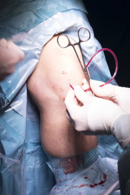 Cerrahi operasyon diz cerrahisi