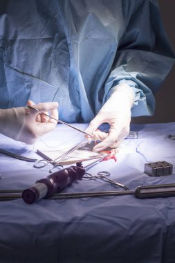 Diz tendon bağ ameliyatı