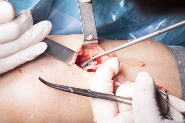 Surgical operation knee surgery