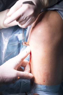 Cerrahi operasyon diz cerrahisi