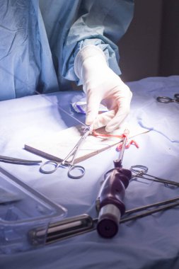 Diz tendon bağ ameliyatı