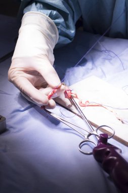 Diz tendon bağ ameliyatı