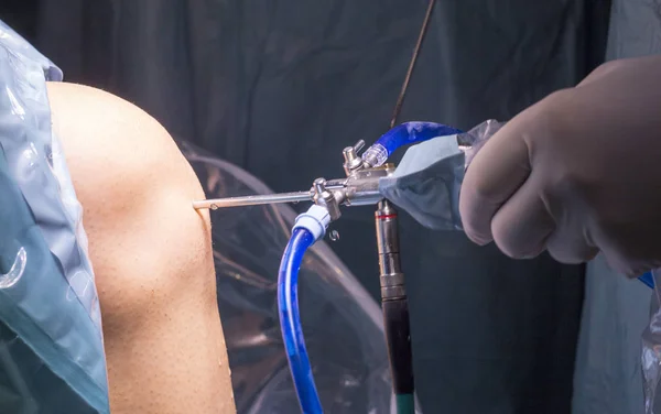 Cerrahi operasyon diz cerrahisi