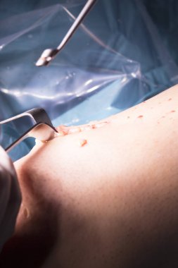 Cerrahi operasyon diz cerrahisi