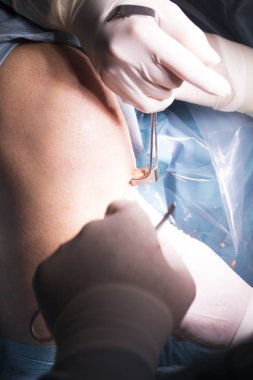 Cerrahi operasyon diz cerrahisi