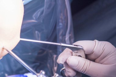 Cerrahi operasyon diz cerrahisi