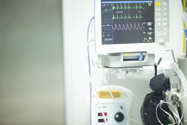 Электрокардиография в больнице — стоковое фото