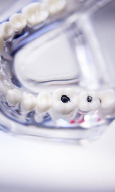 Diş hekimleri diş diş modeli