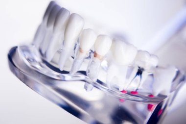 Diş hekimleri diş diş modeli