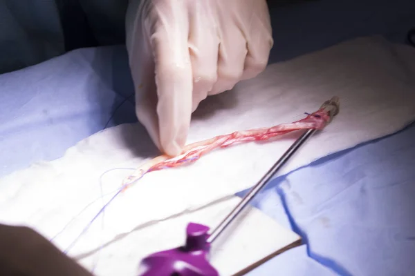 Хірургічне втручання сухожилля коліна — стокове фото