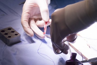 Diz tendon bağ ameliyatı