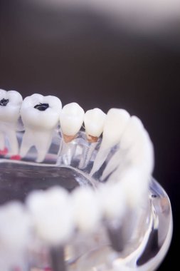 Diş hekimleri diş diş modeli