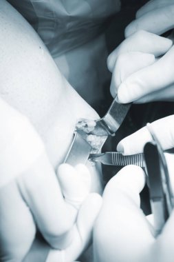 Cerrahi operasyon diz cerrahisi