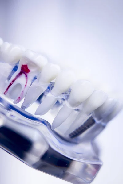 Dientes dentales canal radicular —  Fotos de Stock
