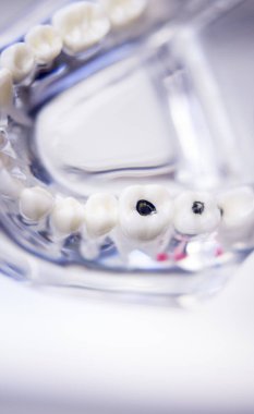 Diş hekimleri diş diş modeli