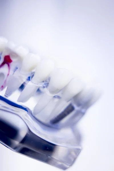 Dental teeth root canal — Stock Photo, Image