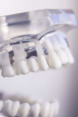 Diş hekimleri diş diş modeli