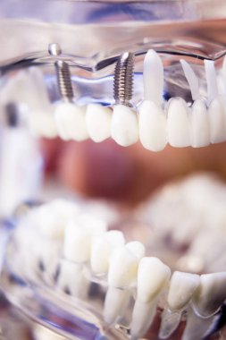 Diş hekimleri diş diş modeli