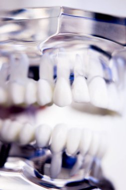 Diş hekimleri diş diş implant