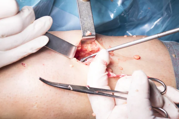 Surgical operation knee surgery