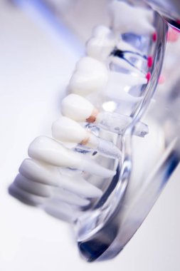 Diş hekimleri diş diş modeli