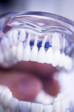 Diş hekimleri diş diş modeli