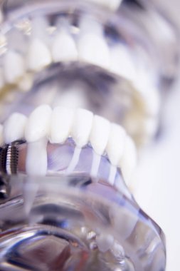 Diş hekimleri diş diş implant