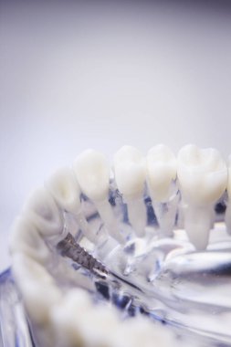 Diş hekimleri diş diş modeli