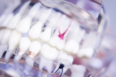 Diş hekimleri diş diş modeli