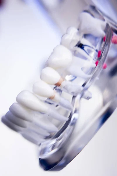 Tandartsen tandheelkundige tanden model — Stockfoto