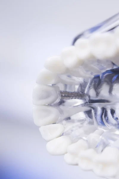 Dentistas modelo de dientes dentales — Foto de Stock