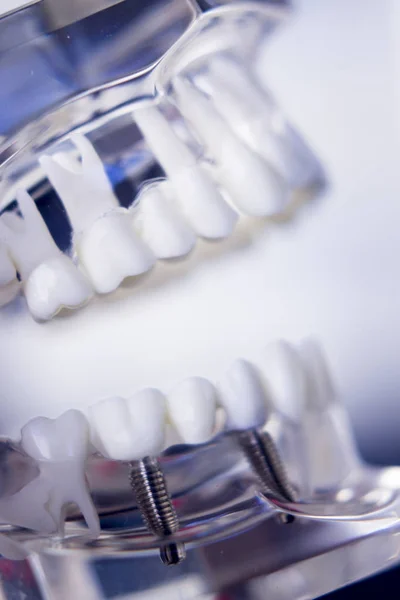 Dentisti modello dentale — Foto Stock