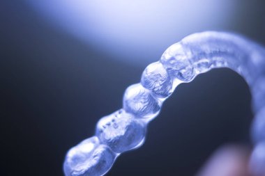 Görünmez diş parantez aligners