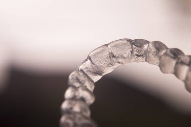 Görünmez diş parantez aligners