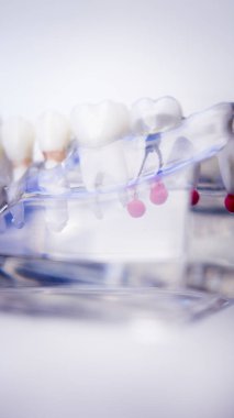 Diş hekimleri diş diş modeli