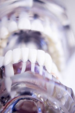 Diş hekimleri diş diş modeli