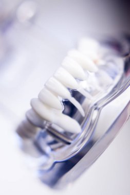 Diş hekimleri diş diş modeli