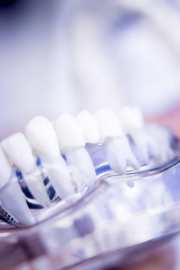 Diş hekimleri diş diş modeli