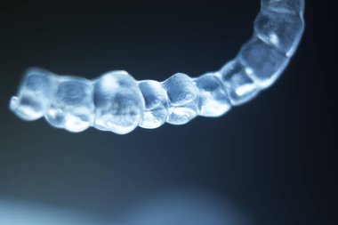 Görünmez diş parantez aligners